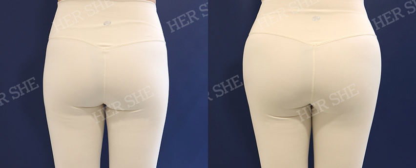 BEFORE & AFTER