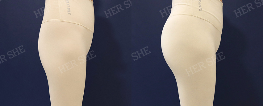 BEFORE & AFTER